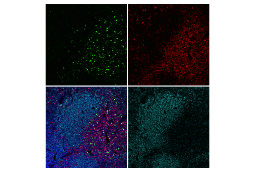 Immunofluorescence Image 2: IL-2Rα/CD25 (E9W2J) XP® Rabbit mAb (BSA and Azide Free)