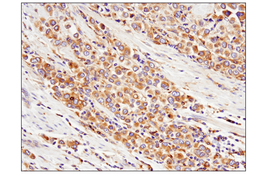 Immunohistochemistry Image 1: Rab7 (E9O7E) Mouse mAb