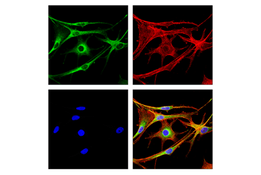 Immunofluorescence Image 4: Rab7 (E9O7E) Mouse mAb