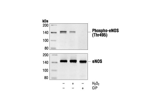 Western Blotting Image 1: Phospho-eNOS (Thr495) Antibody