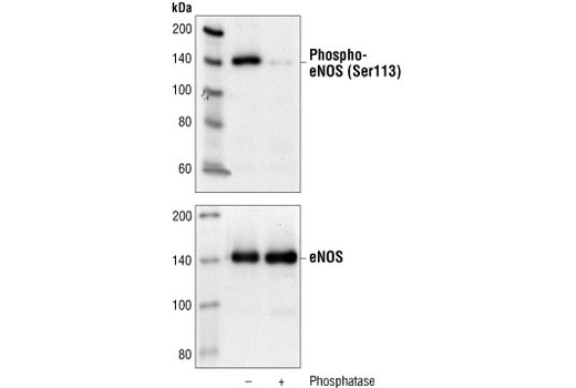 Western Blotting Image 1: Phospho-eNOS (Ser113) Antibody