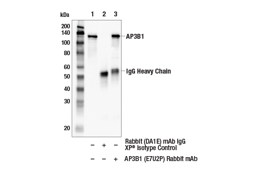 Immunoprecipitation Image 1: AP3B1 (E7U2P) Rabbit mAb