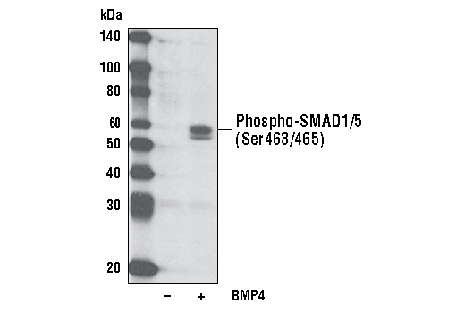 Western Blotting Image 1: Phospho-SMAD1/5 (Ser463/465) (41D10) Rabbit mAb (Biotinylated)