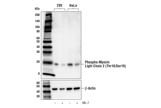 Western Blotting Image 1: Phospho-Myosin Light Chain 2 (Thr18/Ser19) (E2J8F) Rabbit mAb