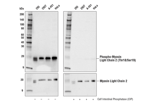 Western Blotting Image 2: Phospho-Myosin Light Chain 2 (Thr18/Ser19) (E2J8F) Rabbit mAb