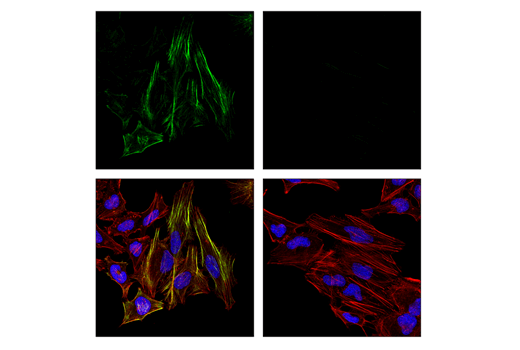 Immunofluorescence Image 1: Phospho-Myosin Light Chain 2 (Thr18/Ser19) (E2J8F) Rabbit mAb