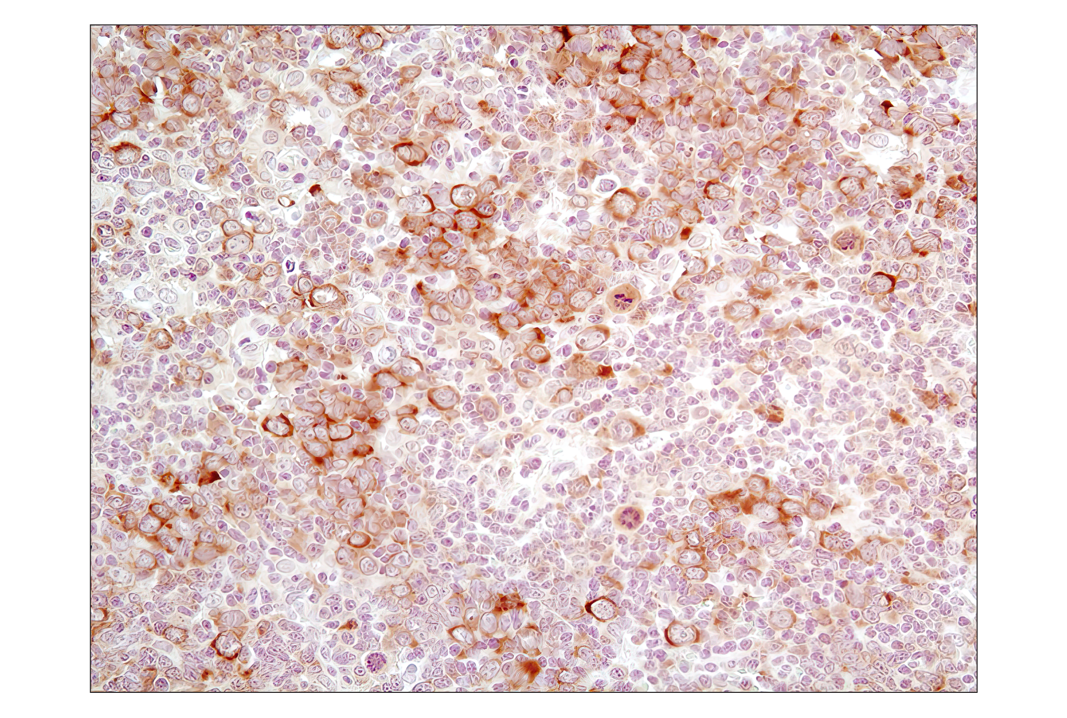 Immunohistochemistry Image 3: Phospho-eIF2α (Ser51) (D9G8) XP® Rabbit mAb (BSA and Azide Free)