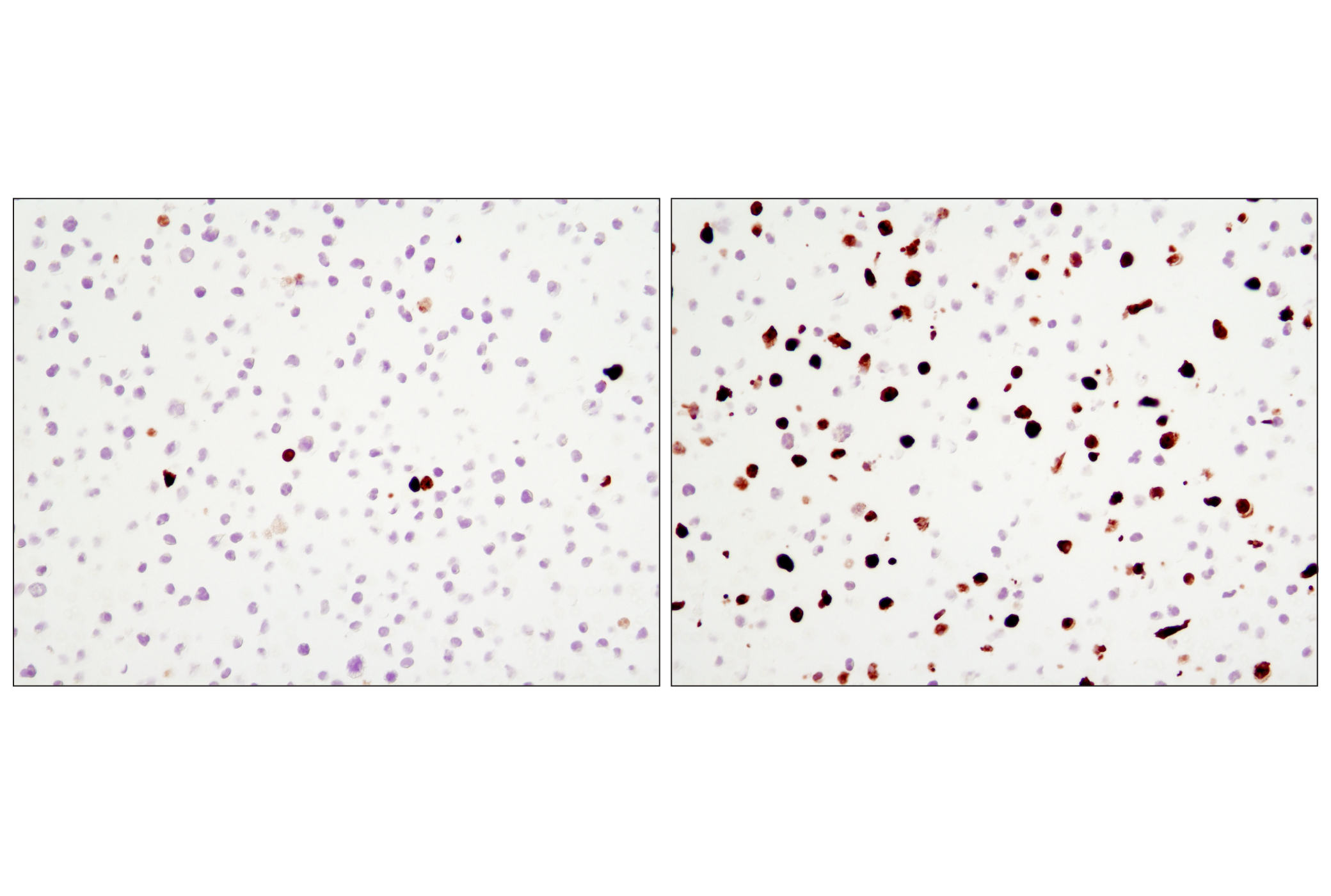 Immunohistochemistry Image 1: Cleaved Caspase-3 (Asp175) (D3E9) Rabbit mAb