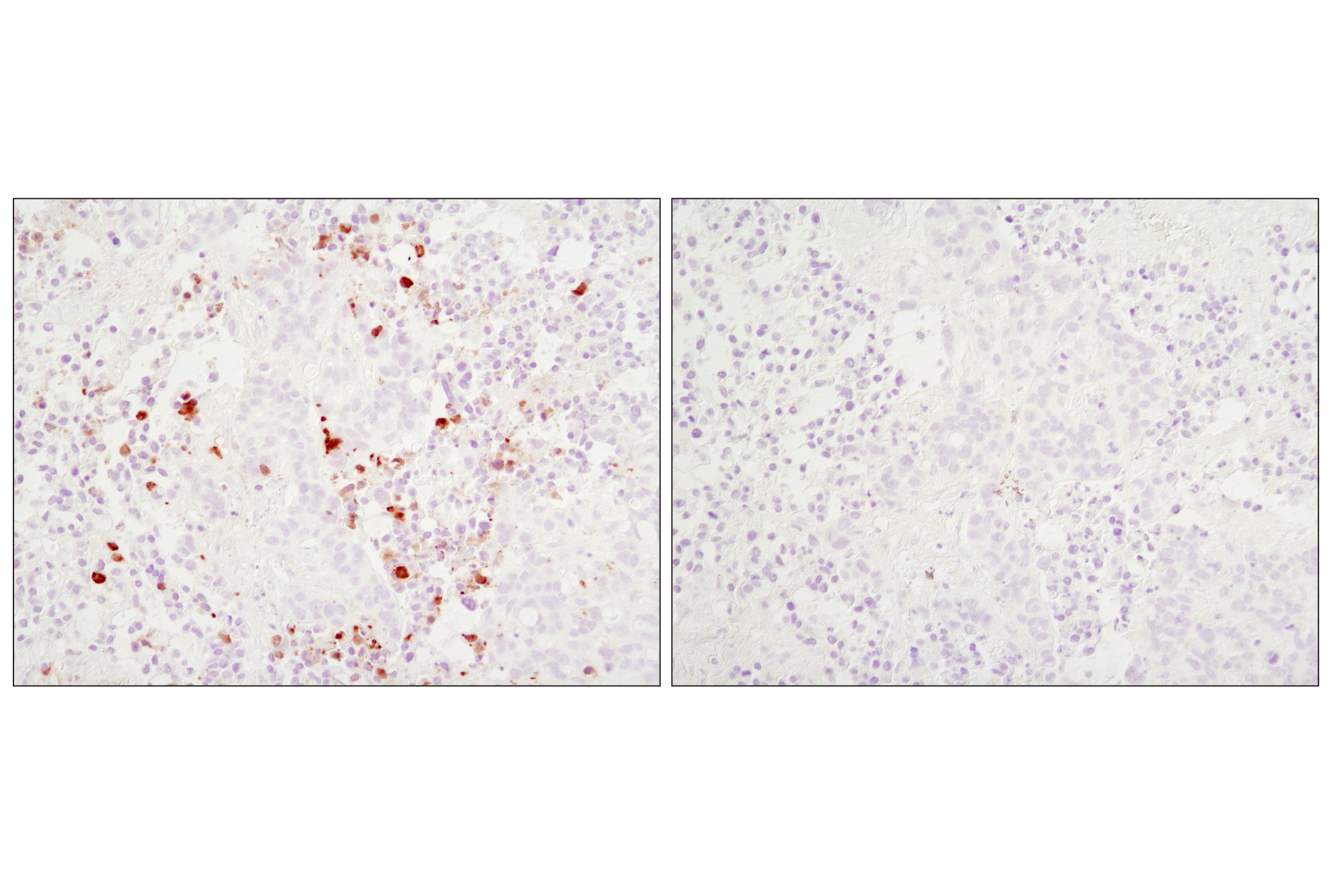 Immunohistochemistry Image 2: Cleaved Caspase-3 (Asp175) (D3E9) Rabbit mAb