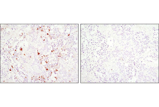 Immunohistochemistry Image 2: Cleaved Caspase-3 (Asp175) (D3E9) Rabbit mAb