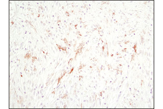 Immunohistochemistry Image 3: Cleaved Caspase-3 (Asp175) (D3E9) Rabbit mAb