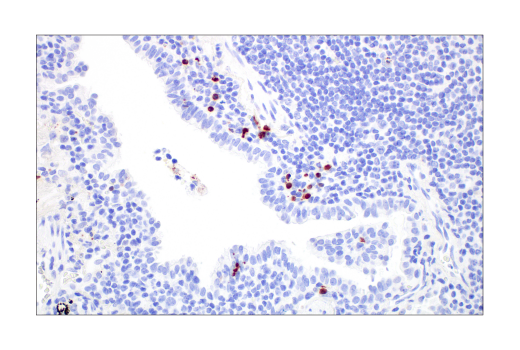 Immunohistochemistry Image 5: Cleaved Caspase-3 (Asp175) (D3E9) Rabbit mAb