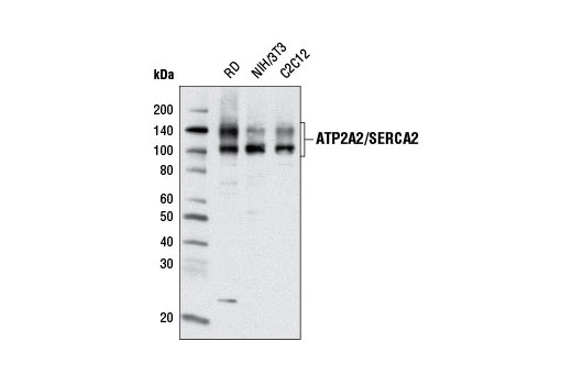 Western Blotting Image 1: ATP2A2/SERCA2 (D51B11) Rabbit mAb