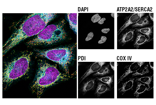 Immunofluorescence Image 1: ATP2A2/SERCA2 (D51B11) Rabbit mAb