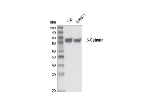 Western Blotting Image 1: β-Catenin Antibody (Amino-terminal Antigen)