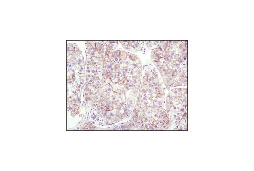 Immunohistochemistry Image 1: β-Catenin (6B3) Rabbit mAb