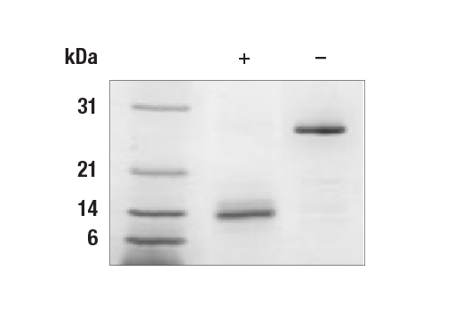  Image 1: Human GDF15 Recombinant Protein