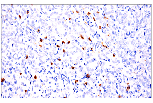 Immunohistochemistry Image 7: CD103/ITGAE (EP206) Rabbit mAb
