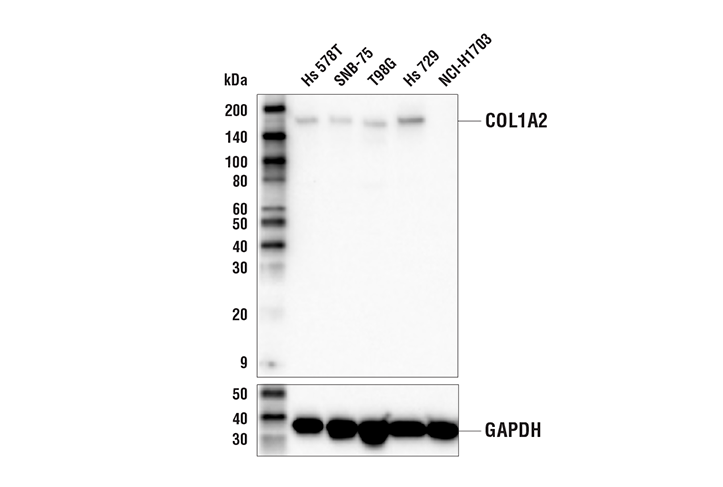 Western Blotting Image 1: COL1A2 Antibody