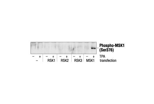Western Blotting Image 1: Phospho-MSK1 (Ser376) Antibody
