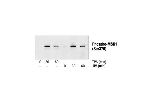 Western Blotting Image 2: Phospho-MSK1 (Ser376) Antibody