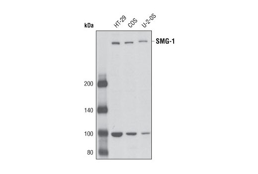 Western Blotting Image 1: SMG-1 (V72) Antibody