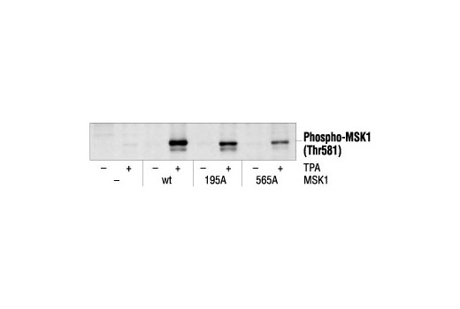 Western Blotting Image 1: Phospho-MSK1 (Thr581) Antibody