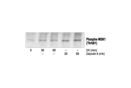 Western Blotting Image 2: Phospho-MSK1 (Thr581) Antibody