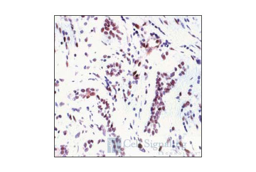  Image 19: Phospho-p38 MAPK Pathway Antibody Sampler Kit