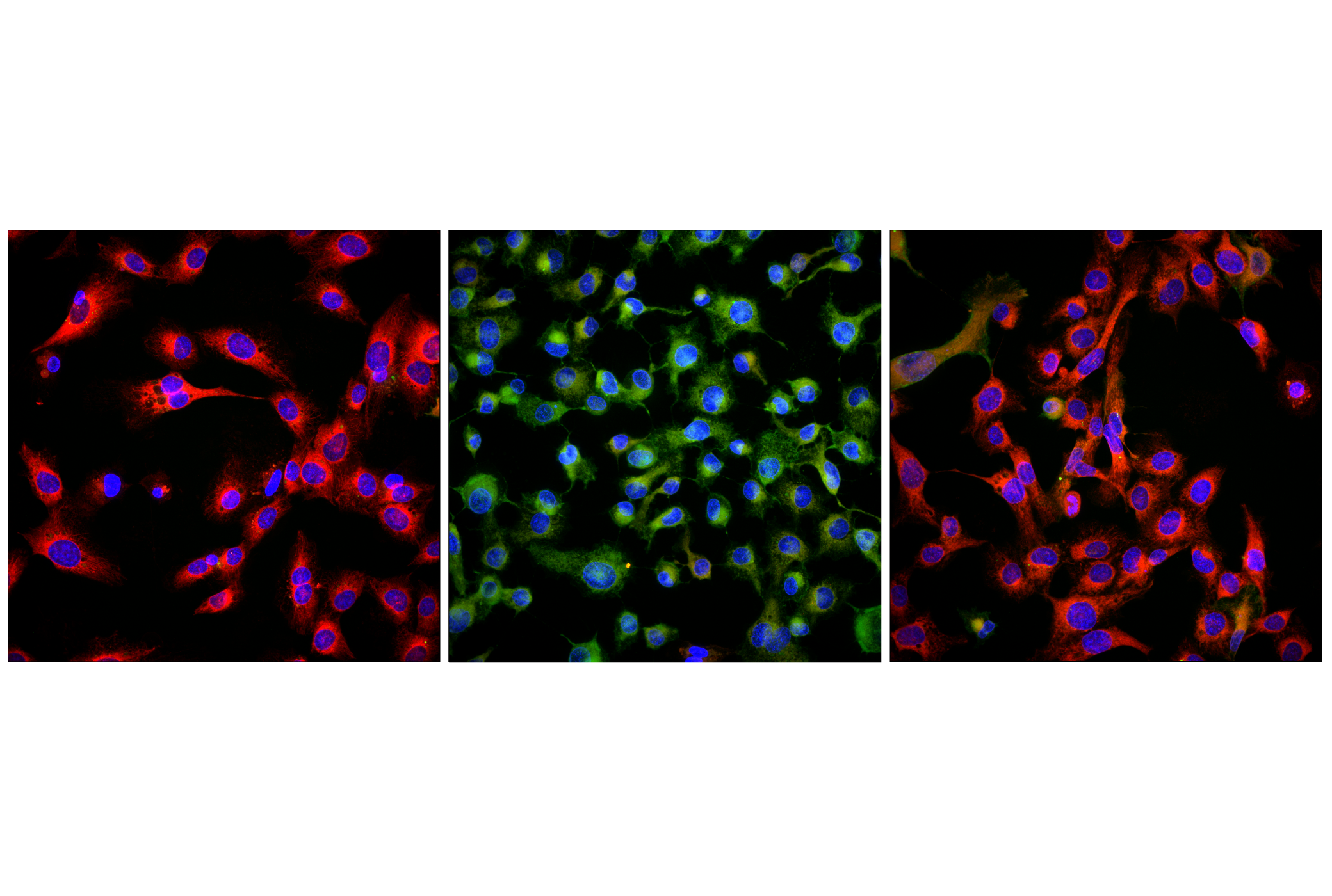 Immunofluorescence Image 1: BODIPY 581/591 C11 (Lipid Peroxidation Sensor)