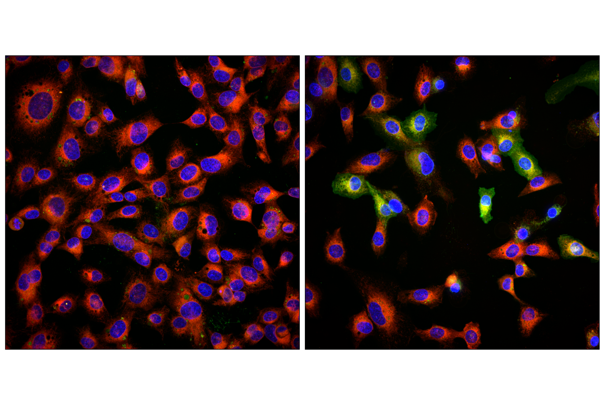 Immunofluorescence Image 2: BODIPY 581/591 C11 (Lipid Peroxidation Sensor)