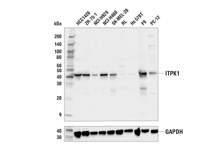 Western Blotting Image 1: ITPK1 Antibody