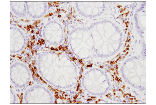 Immunohistochemistry Image 4: CD79B (D7V2F) Rabbit mAb