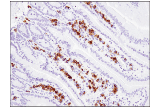 Immunohistochemistry Image 5: CD79B (D7V2F) Rabbit mAb