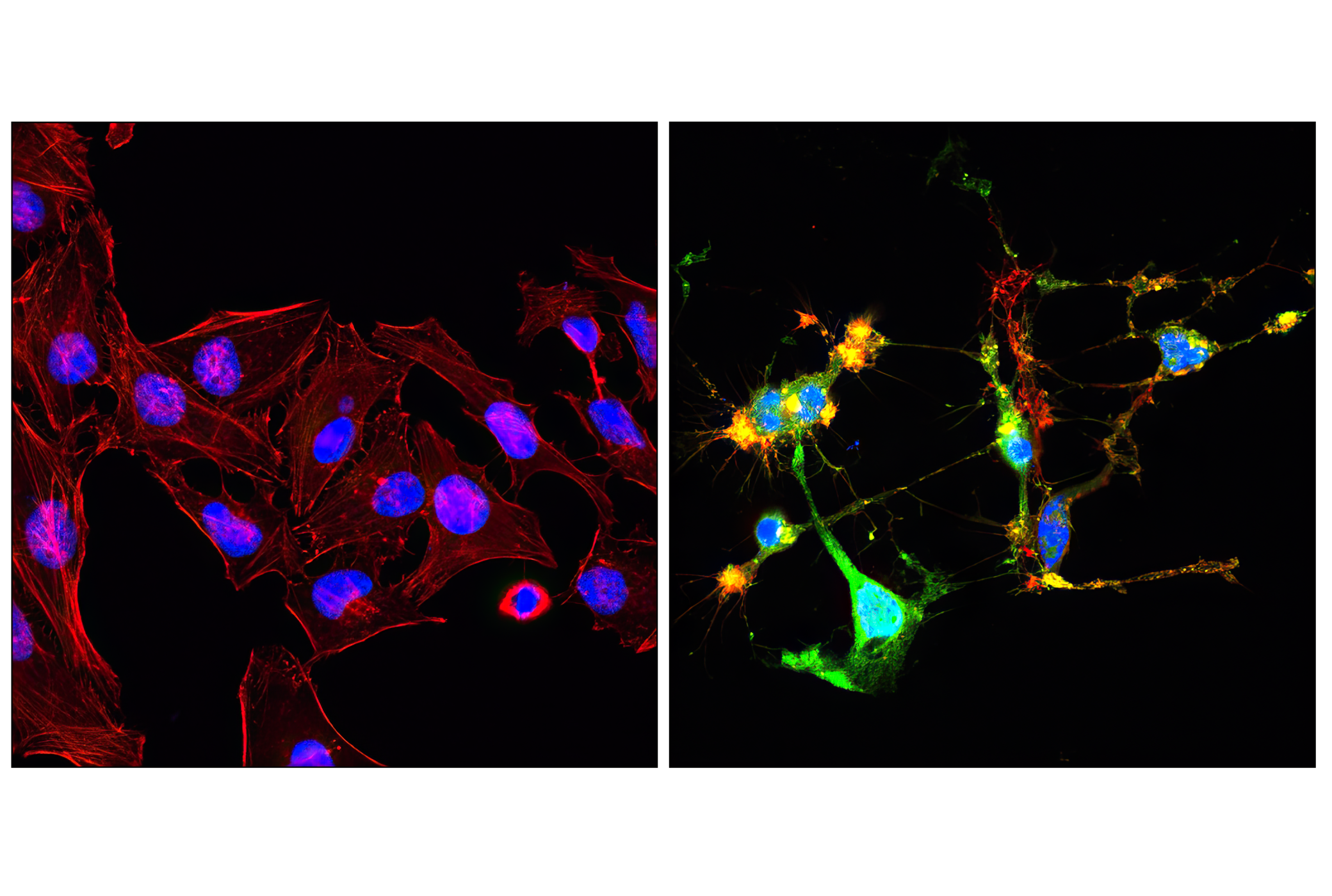 Immunofluorescence Image 1: Cleaved Caspase-3 (Asp175) (D3E9) Rabbit mAb (Alexa Fluor® 488 Conjugate)