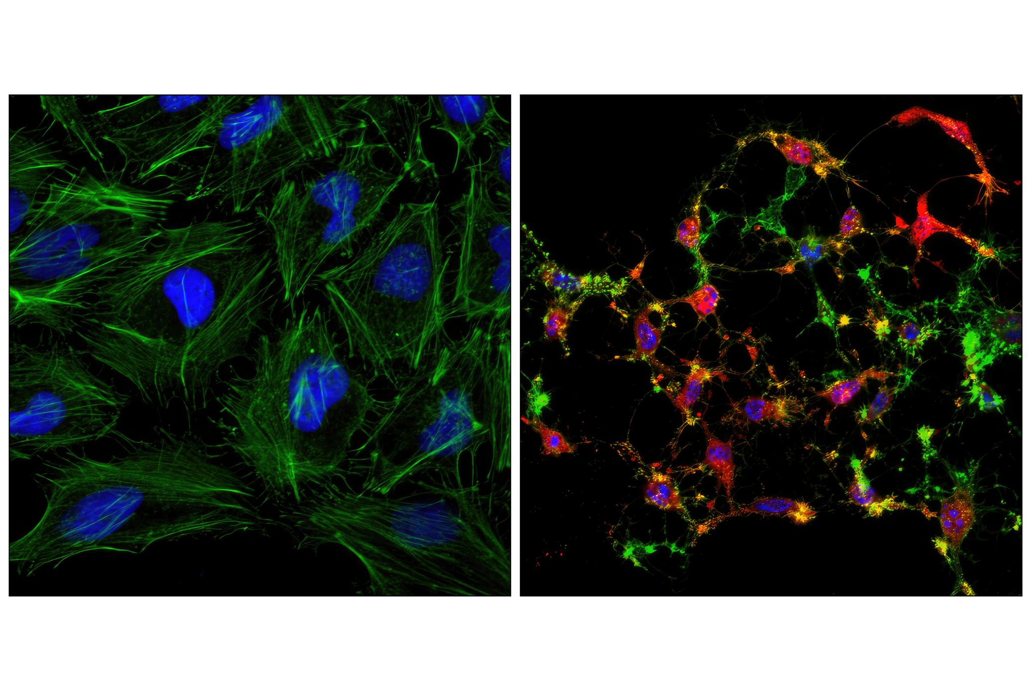Immunofluorescence Image 1: Cleaved Caspase-3 (Asp175) (D3E9) Rabbit mAb (Alexa Fluor® 555 Conjugate)