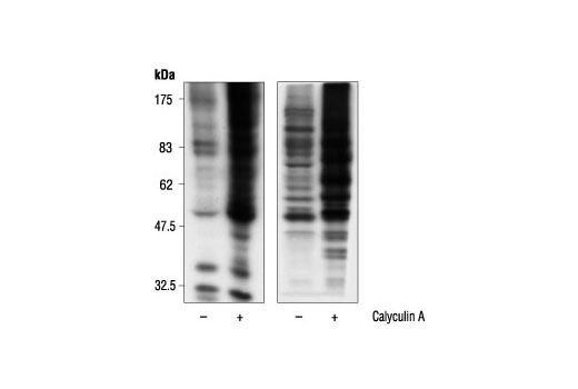  Image 6: Phospho-(Ser) Kinase Substrate Antibody Sampler Kit