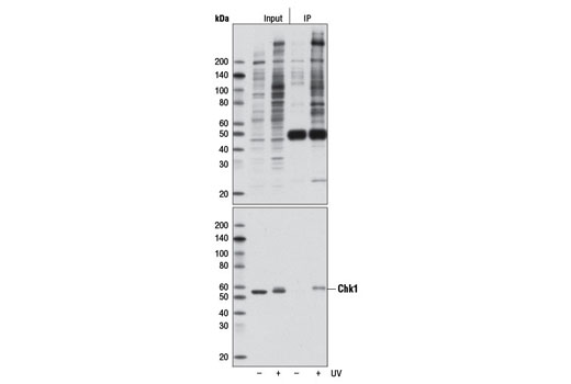 Immunoprecipitation Image 1: Phospho-ATM/ATR Substrate (S*Q) (D23H2/D69H5) MultiMab™ Rabbit mAb mix