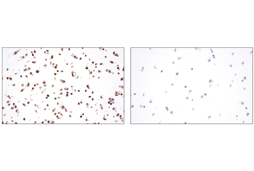 Immunohistochemistry Image 2: GATA-3 (E2N1Y) Mouse mAb