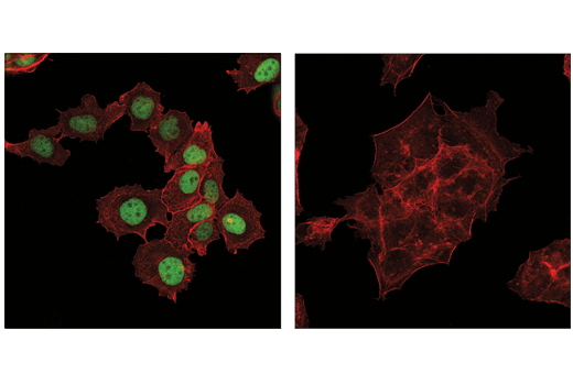Immunofluorescence Image 1: GATA-3 (E2N1Y) Mouse mAb