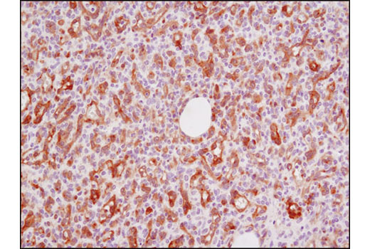 Immunohistochemistry Image 2: VEGF Receptor 2 (D5B1) Rabbit mAb (BSA and Azide Free)
