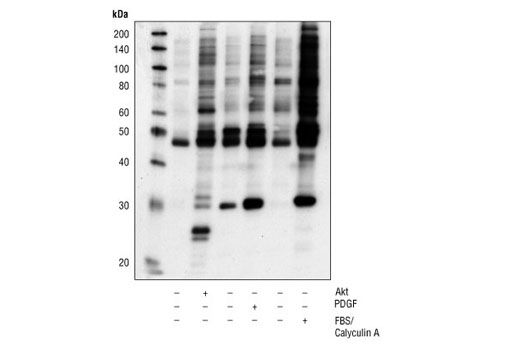  Image 6: Phospho-(Ser/Thr) Kinase Substrate Antibody Sampler Kit