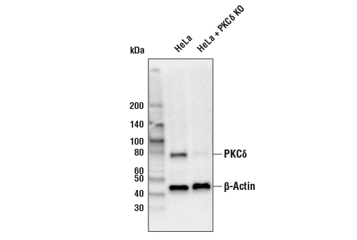  Image 5: PKC Isoform Antibody Sampler Kit