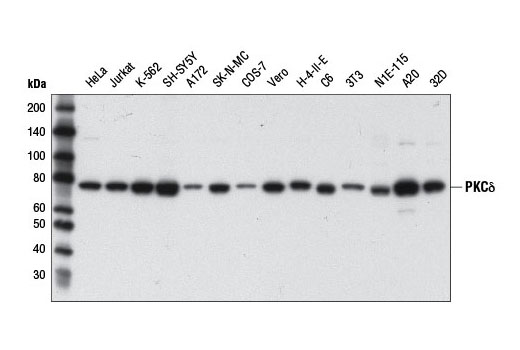  Image 9: PKC Isoform Antibody Sampler Kit