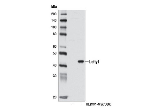 Western Blotting Image 1: Lefty1 Antibody