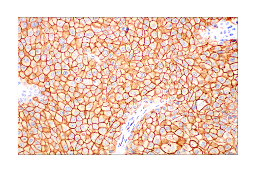 Immunohistochemistry Image 3: Phospho-Tyrosine (4G10) Mouse mAb