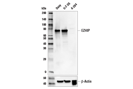 Western Blotting Image 1: EZHIP Antibody