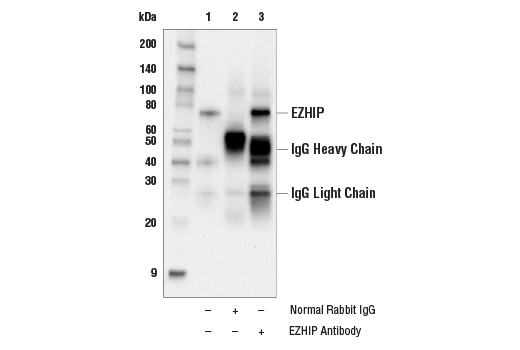 Immunoprecipitation Image 1: EZHIP Antibody