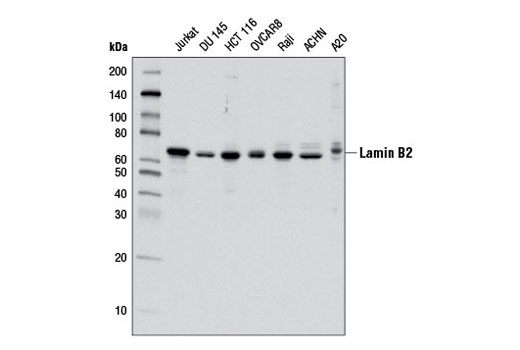 Western Blotting Image 1: Lamin B2 Antibody