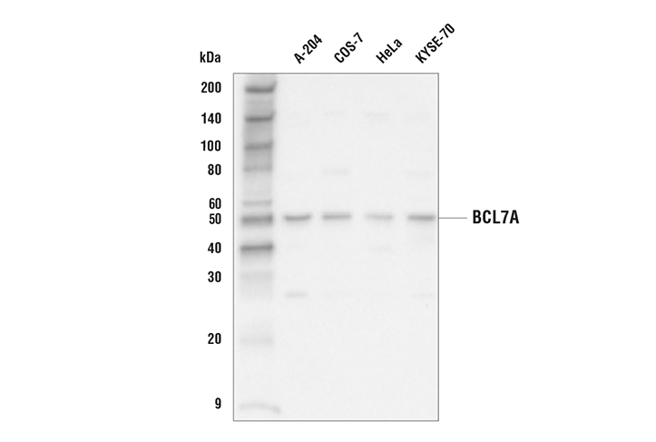 Western Blotting Image 1: BCL7A Antibody